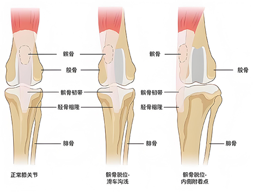 狗狗髌骨脱位